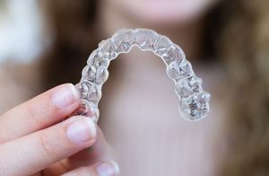 Clear Aligners