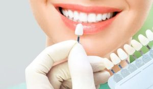 cost of dental veneers