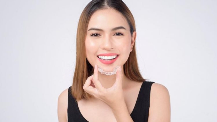 What Does Invisalign Do?